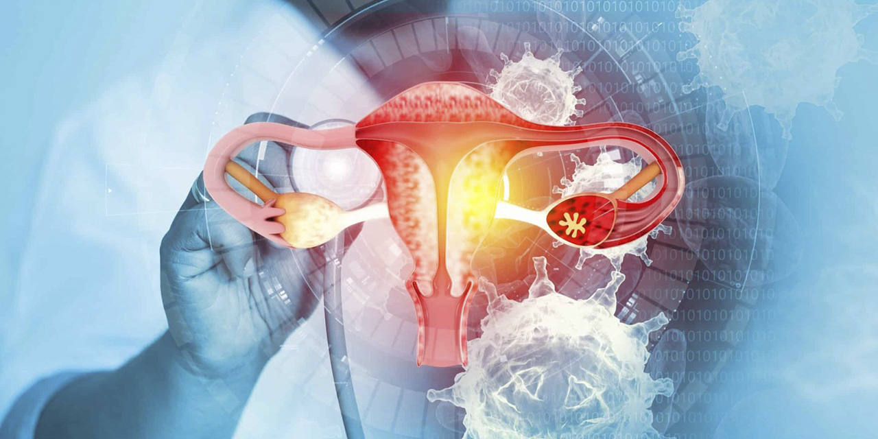 El diagnóstico de cáncer uterino salva vidas de miles de mujeres en el mundo