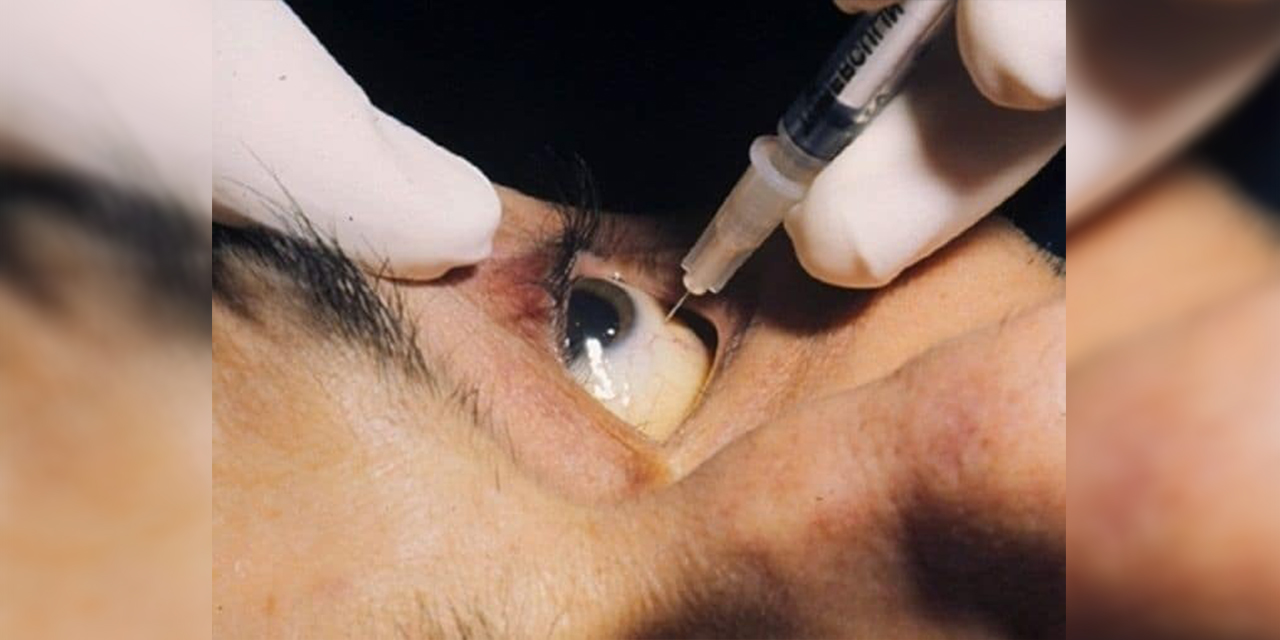Bolivia tiene un nuevo medicamento que previene la ceguera por diabetes y degeneración macular  