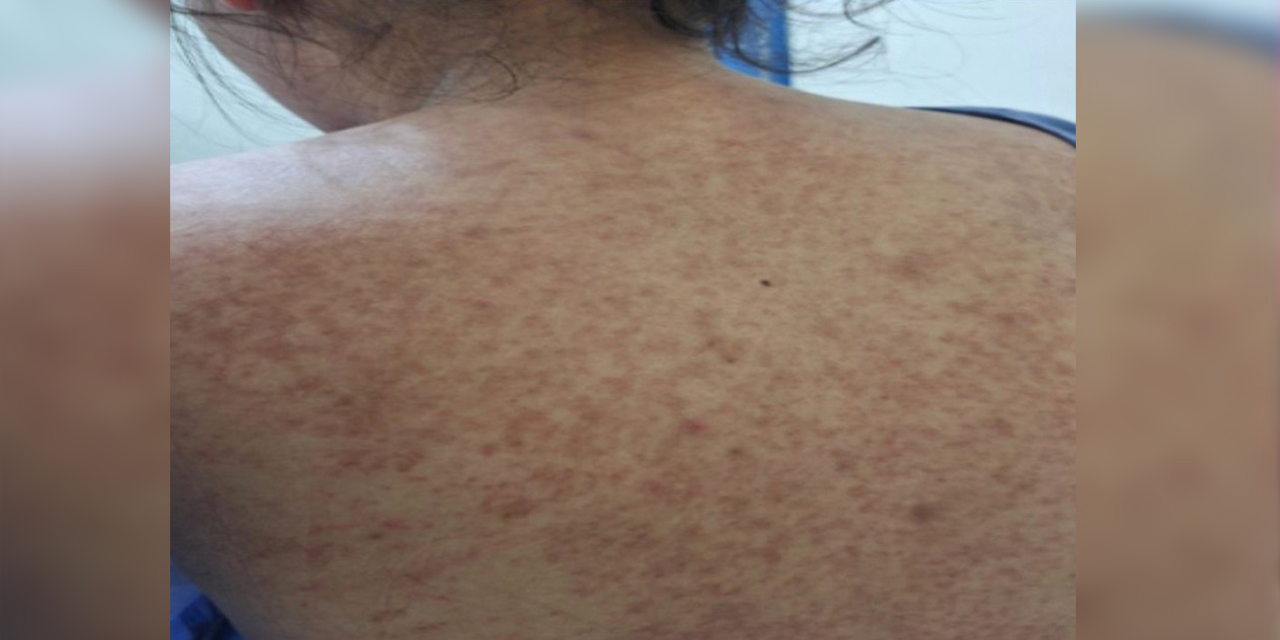 Foto: Ministerio de Salud