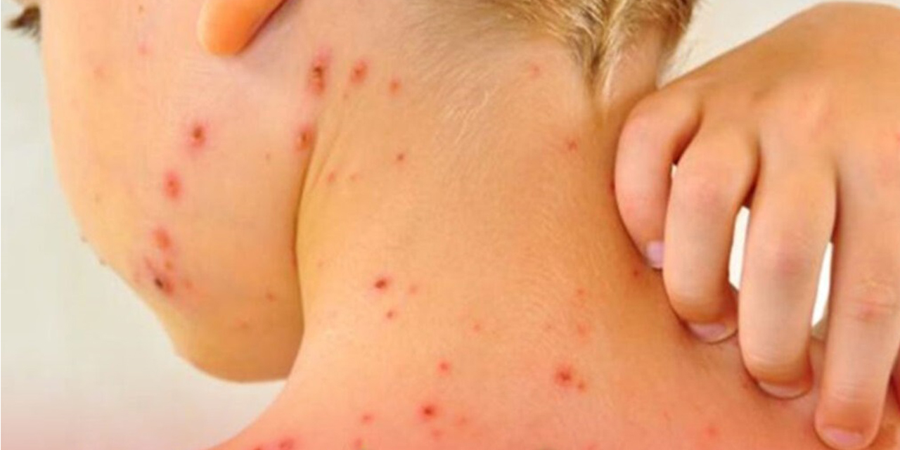 Viacha activa cerco epidemiológico con más de 100 brigadas médicas