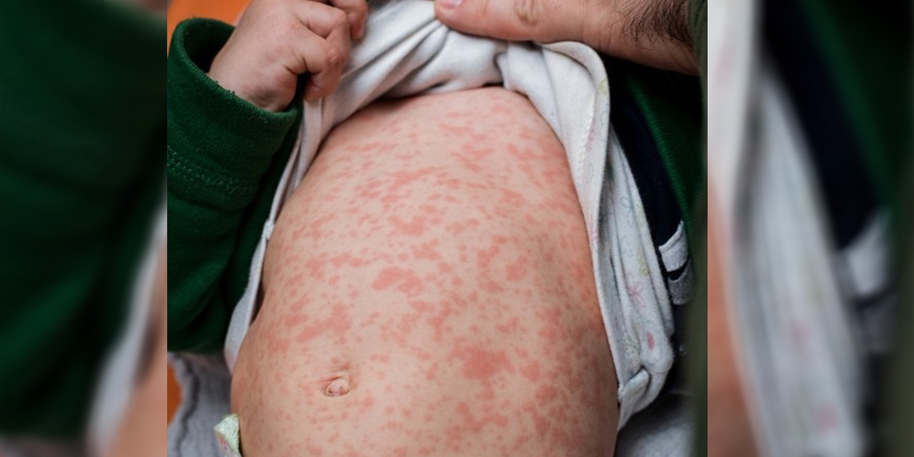 Primer infectado en Chuquisaca y los casos ya suman 86 en el país