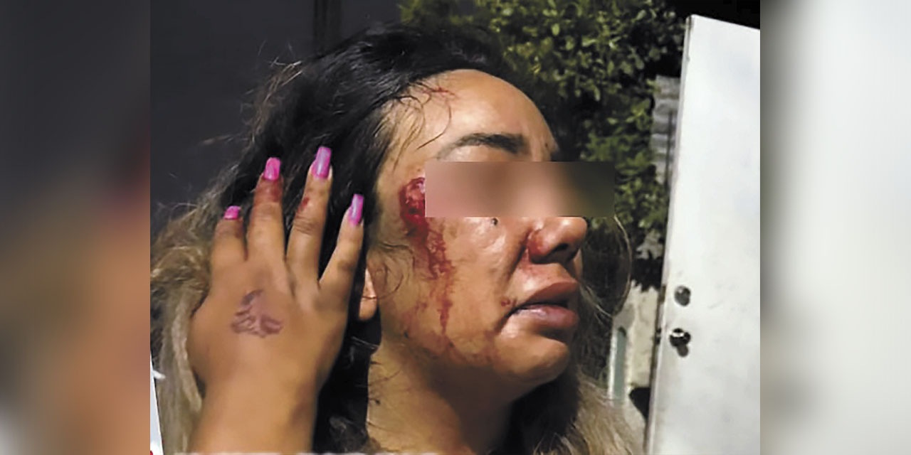 Una mujer víctima de violencia familiar.